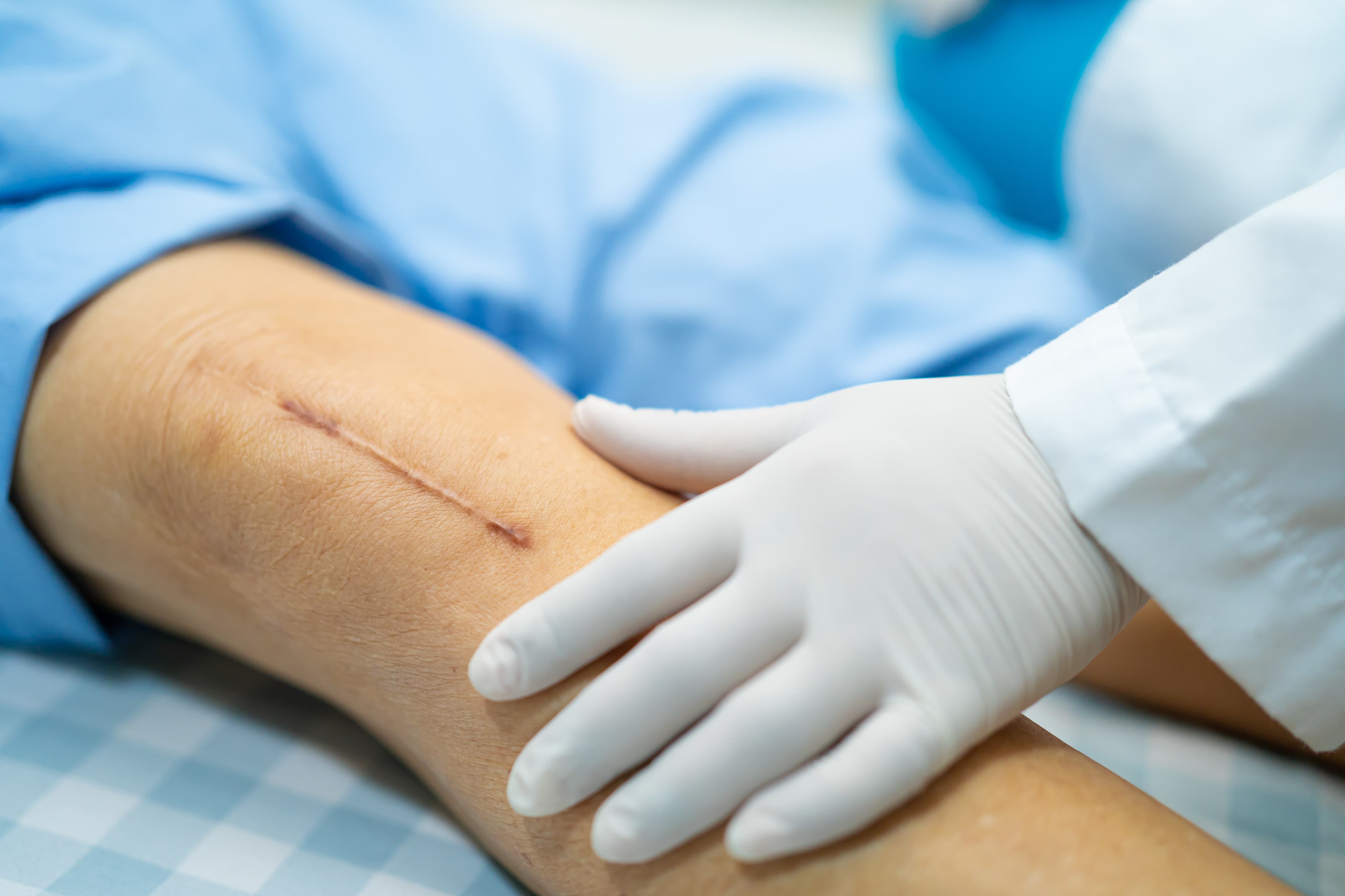 CWCN-AP Exam Prep - Wound Care Nursing Review CWCN-AP exam prep - clinician examining a patient leg wound | Wound Care Nursing Review